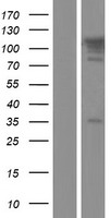TBC1D2B Protein - Western validation with an anti-DDK antibody * L: Control HEK293 lysate R: Over-expression lysate