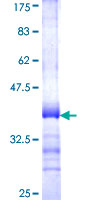 TBC1D3 Protein - 12.5% SDS-PAGE Stained with Coomassie Blue.