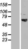 TBC1D3B Protein - Western validation with an anti-DDK antibody * L: Control HEK293 lysate R: Over-expression lysate