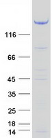 TBC1D4 / AS160 Protein - Purified recombinant protein TBC1D4 was analyzed by SDS-PAGE gel and Coomassie Blue Staining