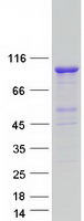 TBC1D5 Protein - Purified recombinant protein TBC1D5 was analyzed by SDS-PAGE gel and Coomassie Blue Staining