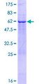 TBC1D7 Protein - 12.5% SDS-PAGE of human TBC1D7 stained with Coomassie Blue