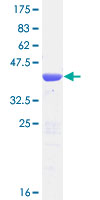 TBCA Protein - 12.5% SDS-PAGE of human TBCA stained with Coomassie Blue