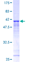 TBCB / CKAP1 Protein - 12.5% SDS-PAGE of human TBCB stained with Coomassie Blue