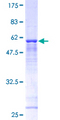 TBCB / CKAP1 Protein - 12.5% SDS-PAGE of human TBCB stained with Coomassie Blue