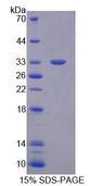TBCB / CKAP1 Protein - Recombinant Tubulin Folding Cofactor B (TBCB) by SDS-PAGE