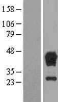 TBCC Protein - Western validation with an anti-DDK antibody * L: Control HEK293 lysate R: Over-expression lysate