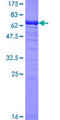 TBCC Protein - 12.5% SDS-PAGE of human TBCC stained with Coomassie Blue