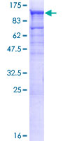 TBCK / TBCKL Protein - 12.5% SDS-PAGE of human MGC16169 stained with Coomassie Blue
