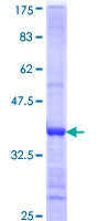 TBCK / TBCKL Protein - 12.5% SDS-PAGE Stained with Coomassie Blue