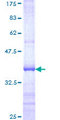 TBL1X / TBL1 Protein - 12.5% SDS-PAGE Stained with Coomassie Blue.