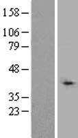 TBL1XR1 / TBLR1 Protein - Western validation with an anti-DDK antibody * L: Control HEK293 lysate R: Over-expression lysate