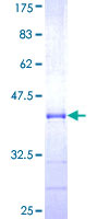 TBL1XR1 / TBLR1 Protein - 12.5% SDS-PAGE Stained with Coomassie Blue.