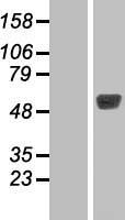 TBL2 Protein - Western validation with an anti-DDK antibody * L: Control HEK293 lysate R: Over-expression lysate