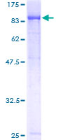 TBL3 Protein - 12.5% SDS-PAGE of human TBL3 stained with Coomassie Blue