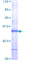 TBP / GTF2D Protein - 12.5% SDS-PAGE Stained with Coomassie Blue