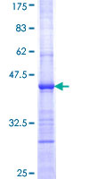 TBPL1 / TRF2 Protein - 12.5% SDS-PAGE Stained with Coomassie Blue.