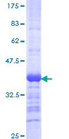 TBR1 Protein - 12.5% SDS-PAGE Stained with Coomassie Blue.