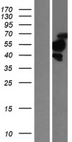 TBRG1 Protein - Western validation with an anti-DDK antibody * L: Control HEK293 lysate R: Over-expression lysate