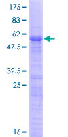 TBRG1 Protein - 12.5% SDS-PAGE of human TBRG1 stained with Coomassie Blue
