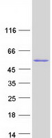 TBRG1 Protein - Purified recombinant protein TBRG1 was analyzed by SDS-PAGE gel and Coomassie Blue Staining