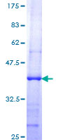 TBRG4 Protein - 12.5% SDS-PAGE Stained with Coomassie Blue.