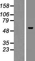 TBX15 Protein - Western validation with an anti-DDK antibody * L: Control HEK293 lysate R: Over-expression lysate