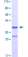 TBX18 Protein - 12.5% SDS-PAGE Stained with Coomassie Blue.