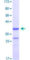 TBX18 Protein - 12.5% SDS-PAGE Stained with Coomassie Blue.