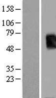 TBX19 / TPIT Protein - Western validation with an anti-DDK antibody * L: Control HEK293 lysate R: Over-expression lysate