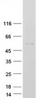 TBX19 / TPIT Protein - Purified recombinant protein TBX19 was analyzed by SDS-PAGE gel and Coomassie Blue Staining