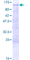 TBX2 Protein - 12.5% SDS-PAGE of human TBX2 stained with Coomassie Blue