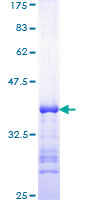 TBX2 Protein - 12.5% SDS-PAGE Stained with Coomassie Blue