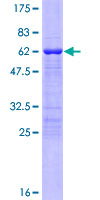 TBX20 Protein - 12.5% SDS-PAGE of human TBX20 stained with Coomassie Blue