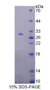 TBX21 / T-bet Protein - Recombinant  T-Box Protein 21 By SDS-PAGE