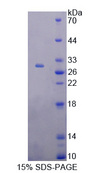 TBX21 / T-bet Protein - Recombinant  T-Box Protein 21 By SDS-PAGE