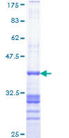 TBX22 Protein - 12.5% SDS-PAGE Stained with Coomassie Blue.