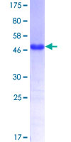 TBX3 Protein - 12.5% SDS-PAGE Stained with Coomassie Blue.
