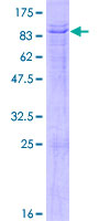 TBX5 Protein - 12.5% SDS-PAGE of human TBX5 stained with Coomassie Blue