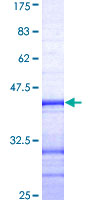 TBX5 Protein - 12.5% SDS-PAGE Stained with Coomassie Blue.