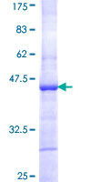 TBX6 Protein - 12.5% SDS-PAGE Stained with Coomassie Blue.