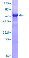TBXT / T / Brachyury Protein - 12.5% SDS-PAGE of human T stained with Coomassie Blue