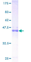 TC21 / RRAS2 Protein - 12.5% SDS-PAGE of human RRAS2 stained with Coomassie Blue