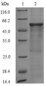 TC21 / RRAS2 Protein - (Tris-Glycine gel) Discontinuous SDS-PAGE (reduced) with 5% enrichment gel and 15% separation gel.