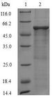 TC21 / RRAS2 Protein - (Tris-Glycine gel) Discontinuous SDS-PAGE (reduced) with 5% enrichment gel and 15% separation gel.