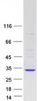 TC21 / RRAS2 Protein - Purified recombinant protein RRAS2 was analyzed by SDS-PAGE gel and Coomassie Blue Staining