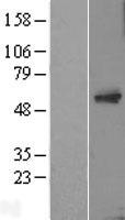 TC2N Protein - Western validation with an anti-DDK antibody * L: Control HEK293 lysate R: Over-expression lysate