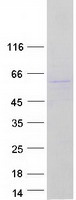 TC2N Protein - Purified recombinant protein TC2N was analyzed by SDS-PAGE gel and Coomassie Blue Staining