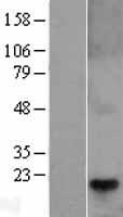 TCAP / Telethonin Protein - Western validation with an anti-DDK antibody * L: Control HEK293 lysate R: Over-expression lysate