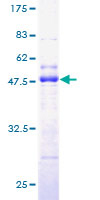 TCAP / Telethonin Protein - 12.5% SDS-PAGE of human TCAP stained with Coomassie Blue